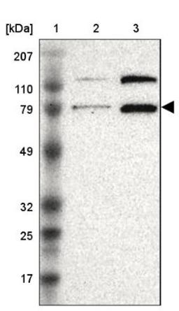 Western Blot: Pinin Antibody [NBP1-87784] - Lane 1: Marker [kDa] 207, 110, 79, 49, 32, 25, 17<br/>Lane 2: Human cell line RT-4<br/>Lane 3: Human cell line EFO-21