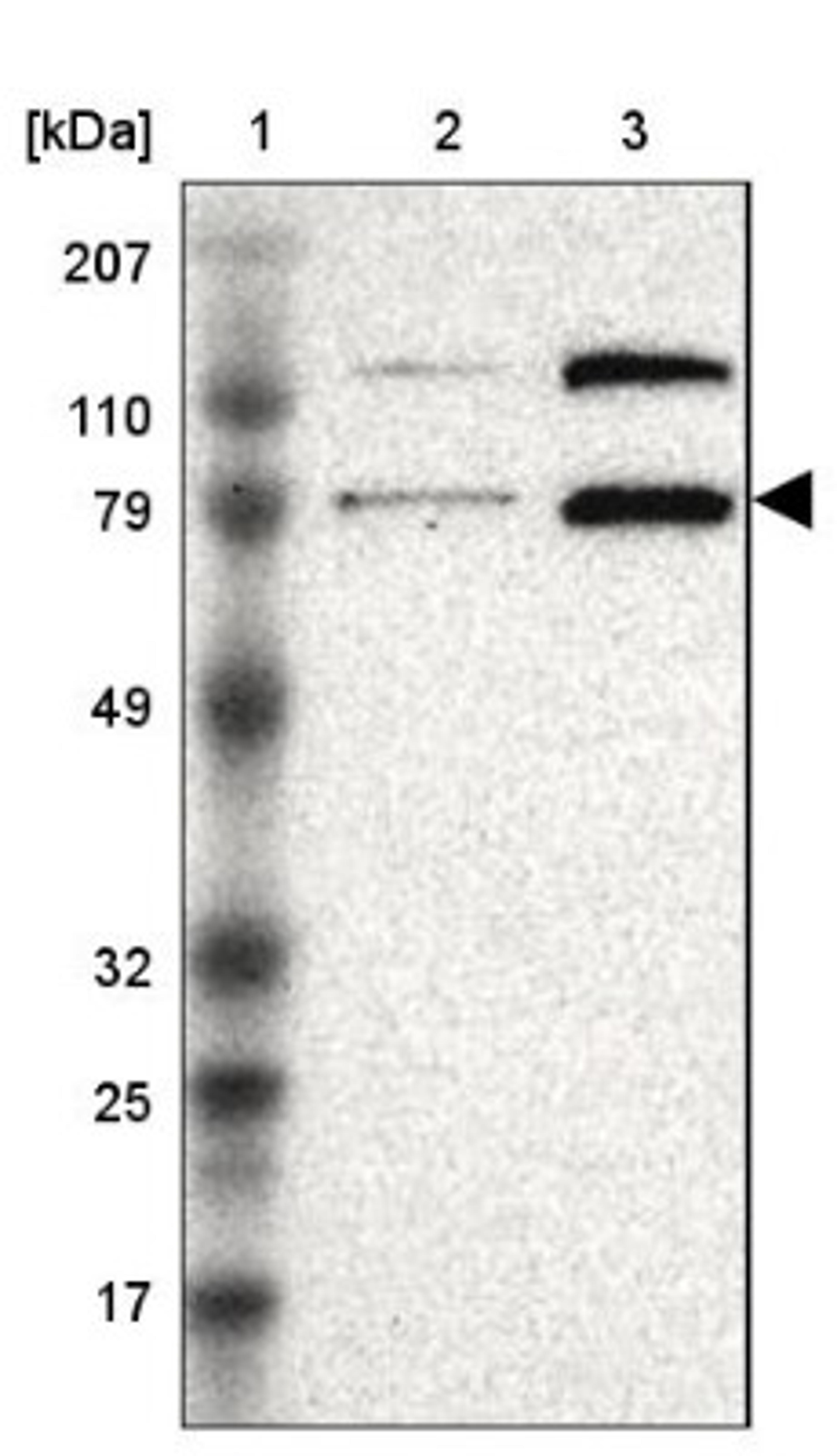 Western Blot: Pinin Antibody [NBP1-87784] - Lane 1: Marker [kDa] 207, 110, 79, 49, 32, 25, 17<br/>Lane 2: Human cell line RT-4<br/>Lane 3: Human cell line EFO-21