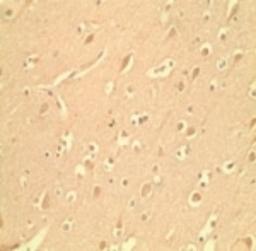 Immunohistochemistry: MD2 Antibody [NB100-56655] - IHC staining of normal human brain using 100-56655 (MD-2)at 10 ug/ml.