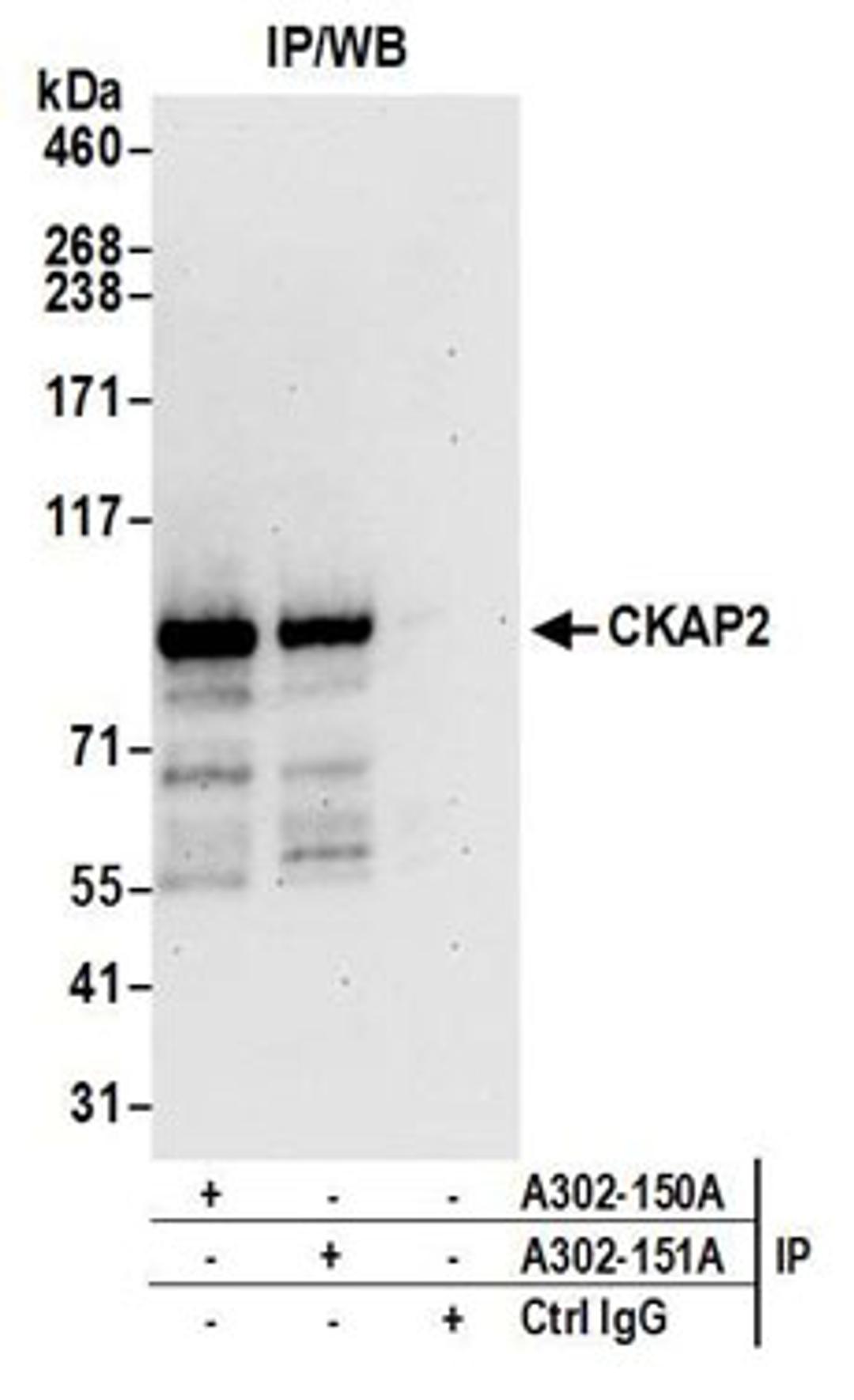 Detection of human CKAP2 by western blot of immunoprecipitates.