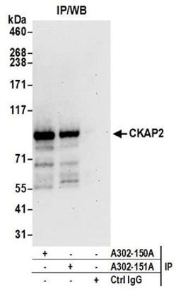 Detection of human CKAP2 by western blot of immunoprecipitates.