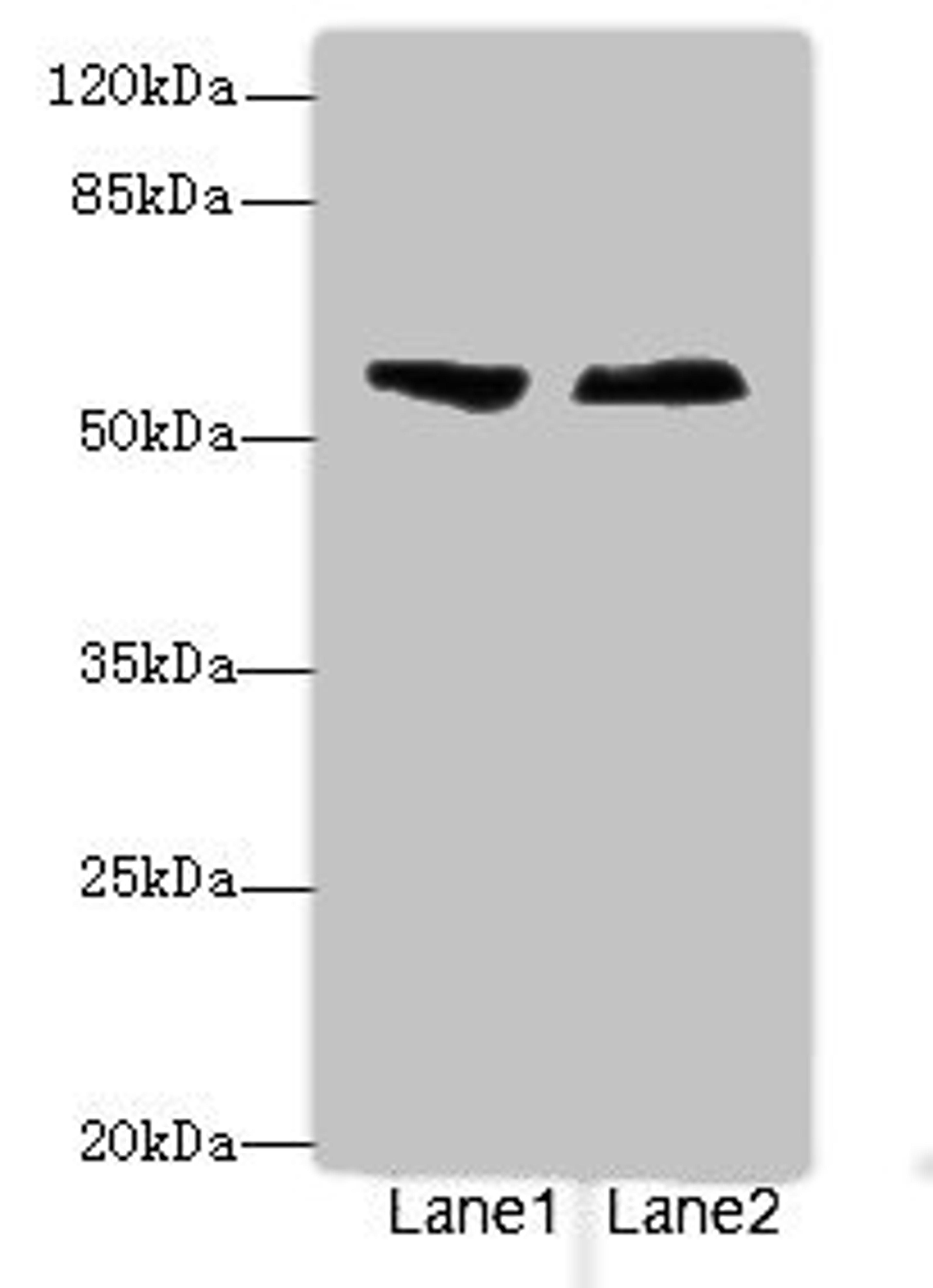 Western blot. All lanes: ENTPD2antibody at 3.6ug/ml. Lane 1: Human placenta tissue. Lane 2: U87 whole cell lysate. Secondary. Goat polyclonal to rabbit IgG at 1/10000 dilution. Predicted band size: 54, 52, 49 kDa. Observed band size: 54 kDa. 