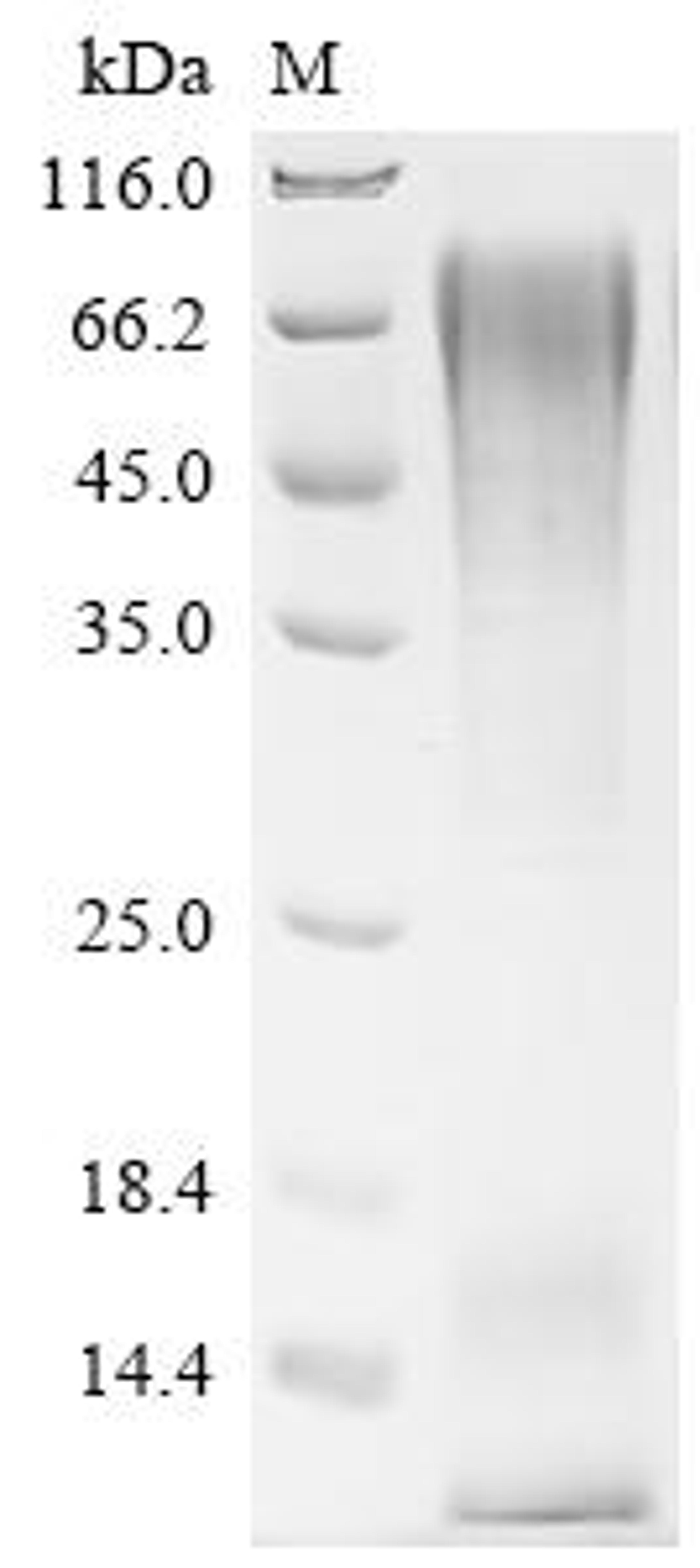 (Tris-Glycine gel) Discontinuous SDS-PAGE (reduced) with 5% enrichment gel and 15% separation gel.