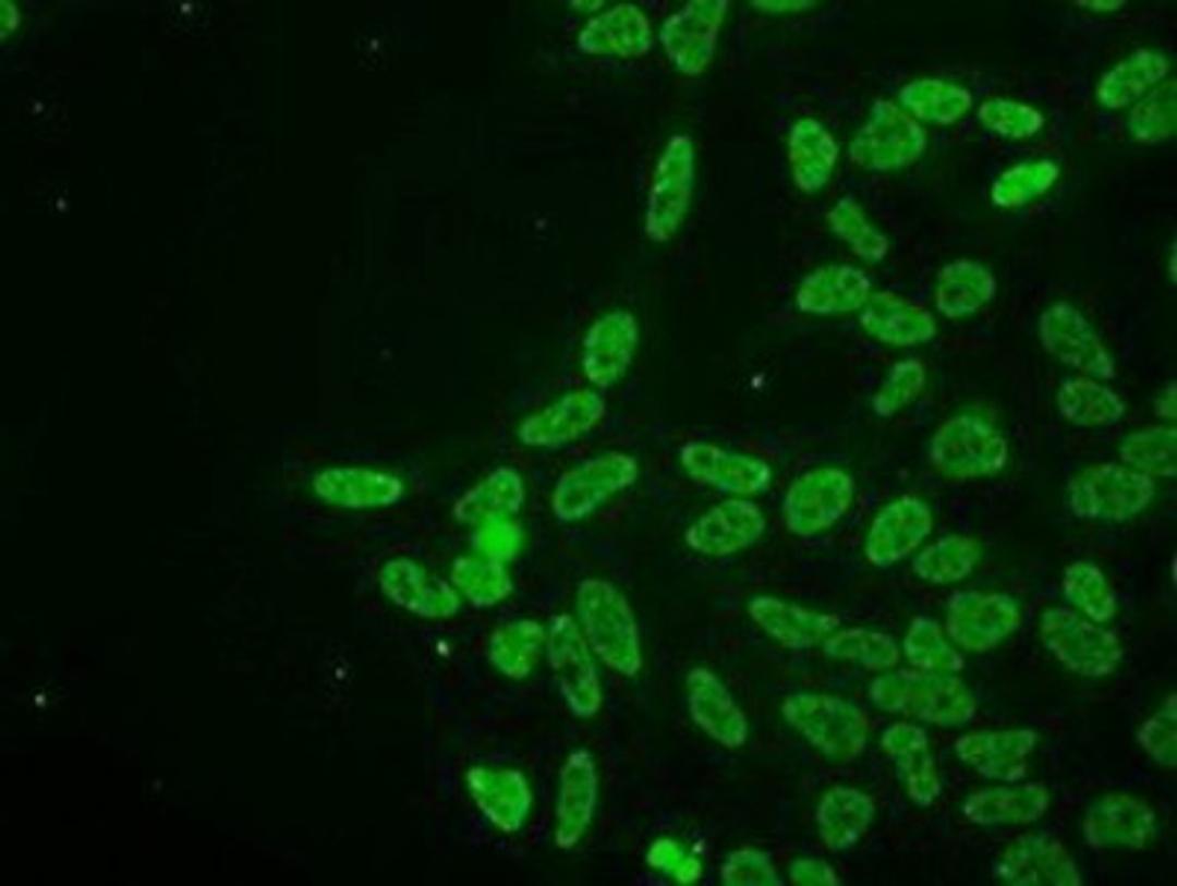 Immunocytochemistry/Immunofluorescence: Protein kinase Y linked Antibody (3E10) [NBP1-48296] - Immunofluorescent staining of HeLa cells using anti-Protein kinase Y linked mouse monoclonal antibody.