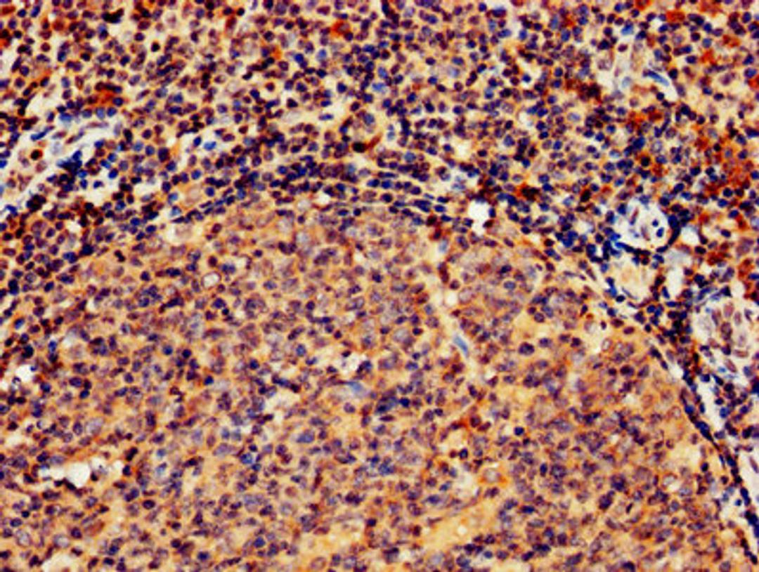 IHC image of CSB-PA010082LA01HU diluted at 1:800 and staining in paraffin-embedded human tonsil tissue performed on a Leica BondTM system. After dewaxing and hydration, antigen retrieval was mediated by high pressure in a citrate buffer (pH 6.0). Section was blocked with 10% normal goat serum 30min at RT. Then primary antibody (1% BSA) was incubated at 4°C overnight. The primary is detected by a biotinylated secondary antibody and visualized using an HRP conjugated SP system.
