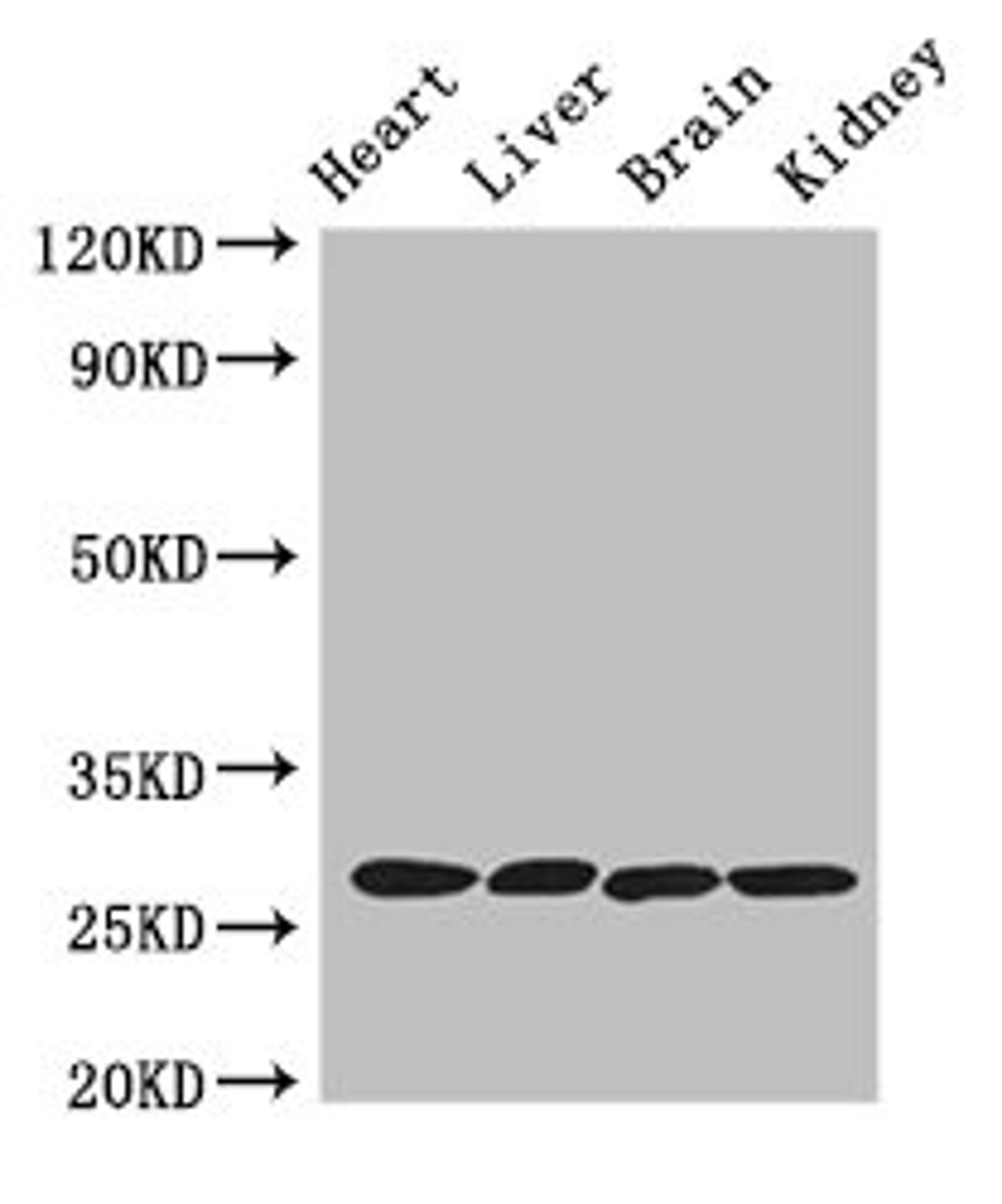 Western Blot. Positive WB detected in: Mouse heart tissue, Mouse liver tissue, Mouse brain tissue, Mouse kidney tissue. All lanes: PRSS2 antibody at 3ug/ml. Secondary. Goat polyclonal to rabbit IgG at 1/50000 dilution. Predicted band size: 27 kDa. Observed band size: 27 kDa.