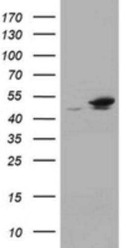 Western Blot: EPHX1 Antibody (3F10) [NBP2-45478] - Analysis of HEK293T cells were transfected with the pCMV6-ENTRY control (Left lane) or pCMV6-ENTRY EPHX1.