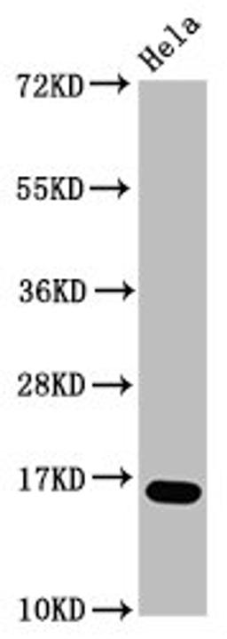 Western Blot. Positive WB detected in: Hela whole cell lysate (treated with 30mM sodium butyrate for 4h). All lanes: HIST1H3A antibody at 1.4µg/ml. Secondary. Goat polyclonal to rabbit IgG at 1/50000 dilution. Predicted band size: 16 kDa. Observed band size: 16 kDa