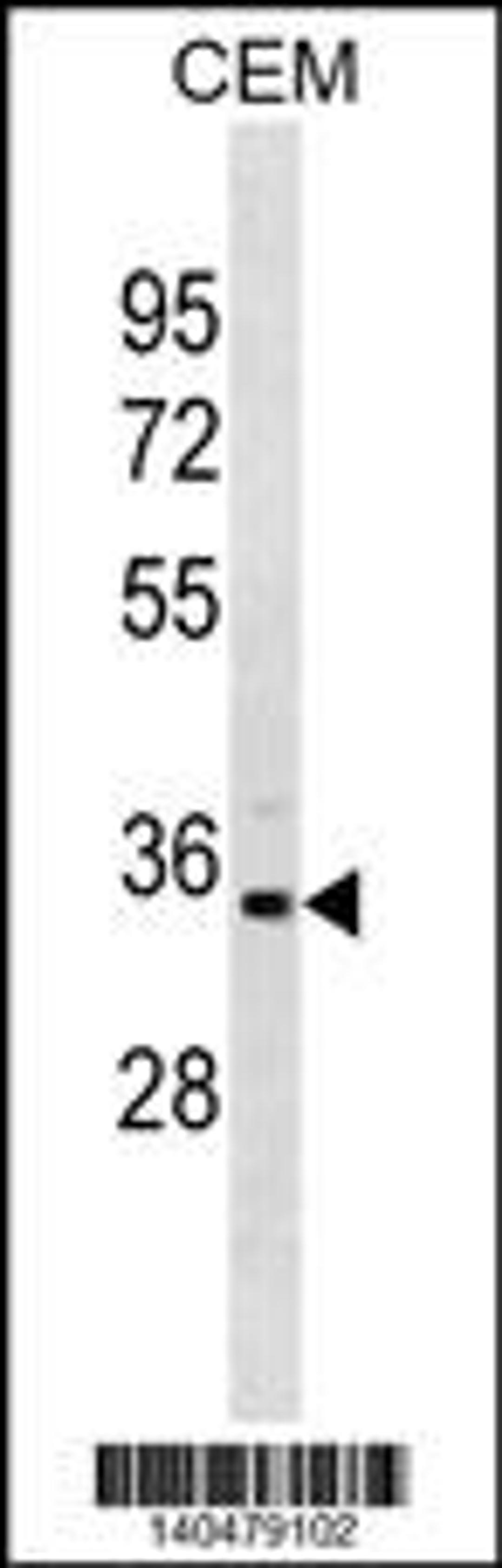 Western blot analysis in CEM cell line lysates (35ug/lane).