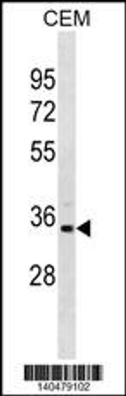 Western blot analysis in CEM cell line lysates (35ug/lane).