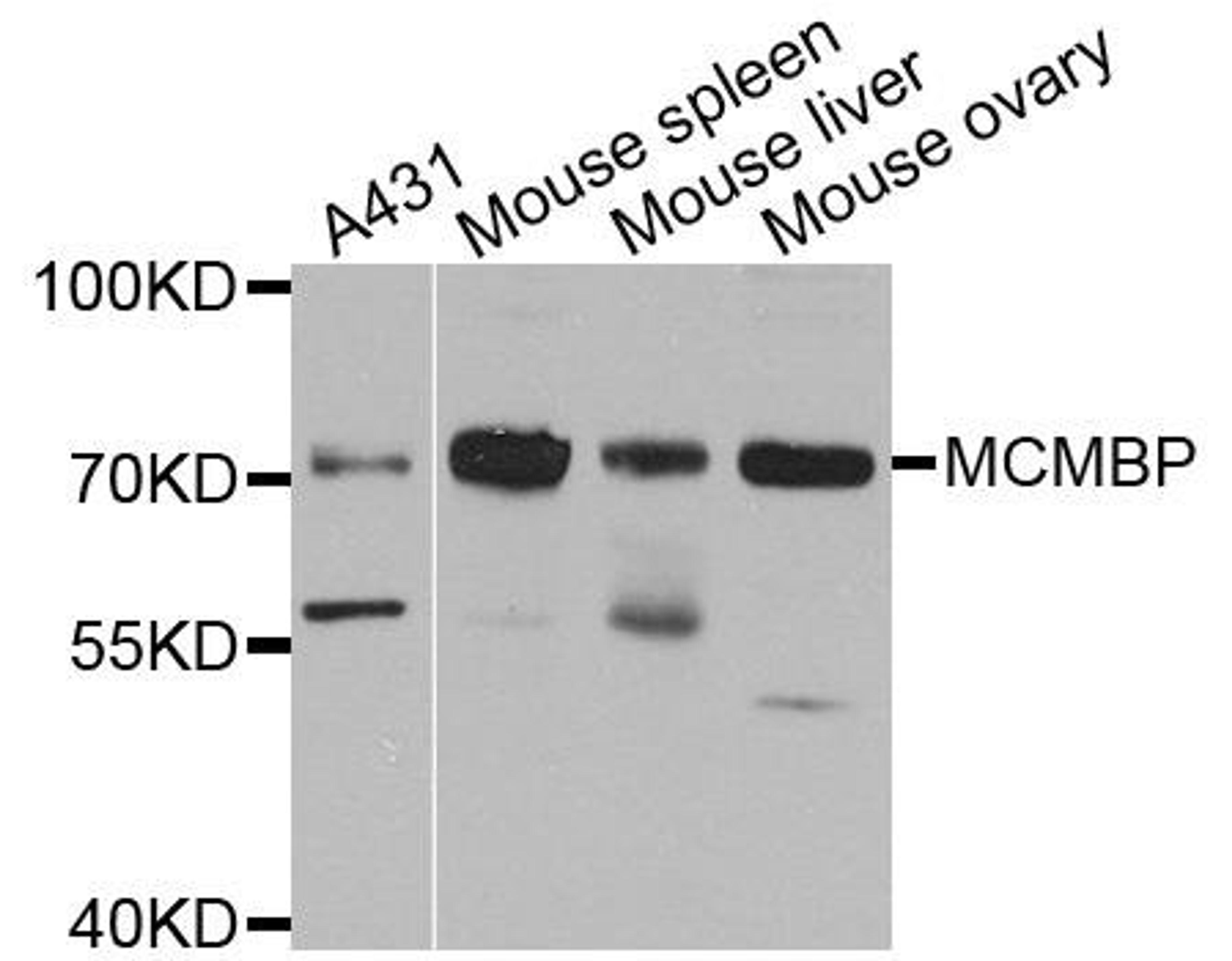 Western blot analysis of extract of various cells using MCMBP antibody