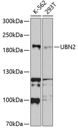 Western blot - UBN2 antibody (A10516)