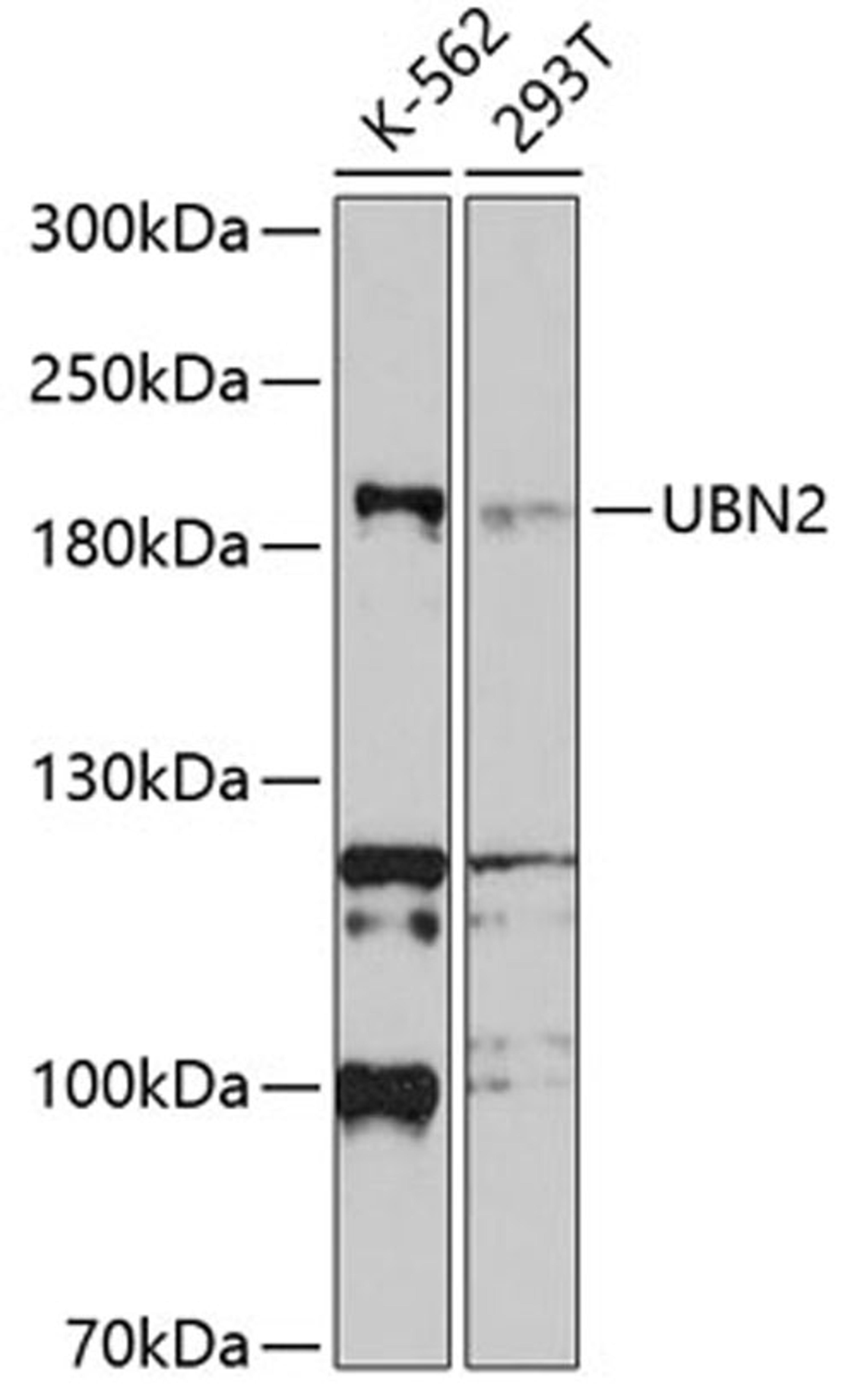 Western blot - UBN2 antibody (A10516)