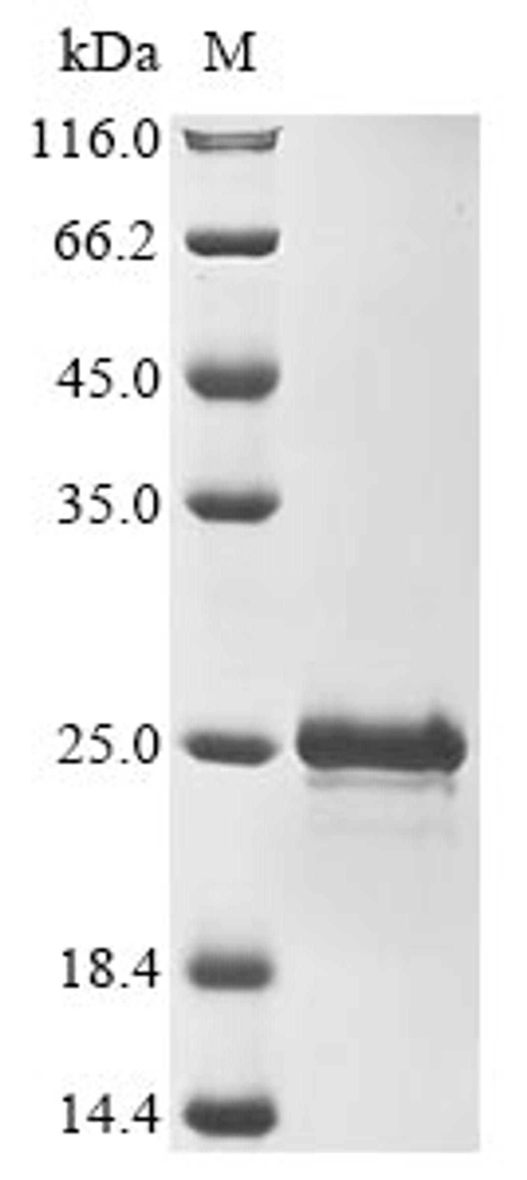 (Tris-Glycine gel) Discontinuous SDS-PAGE (reduced) with 5% enrichment gel and 15% separation gel.