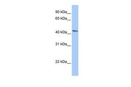 Antibody used in WB on Human HepG2 at 0.2-1 ug/ml.