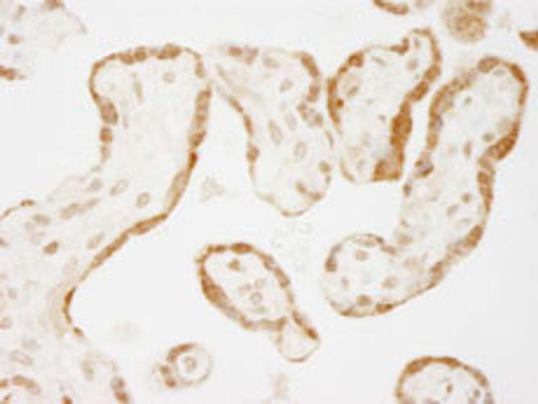 Detection of human NELFE by immunohistochemistry.