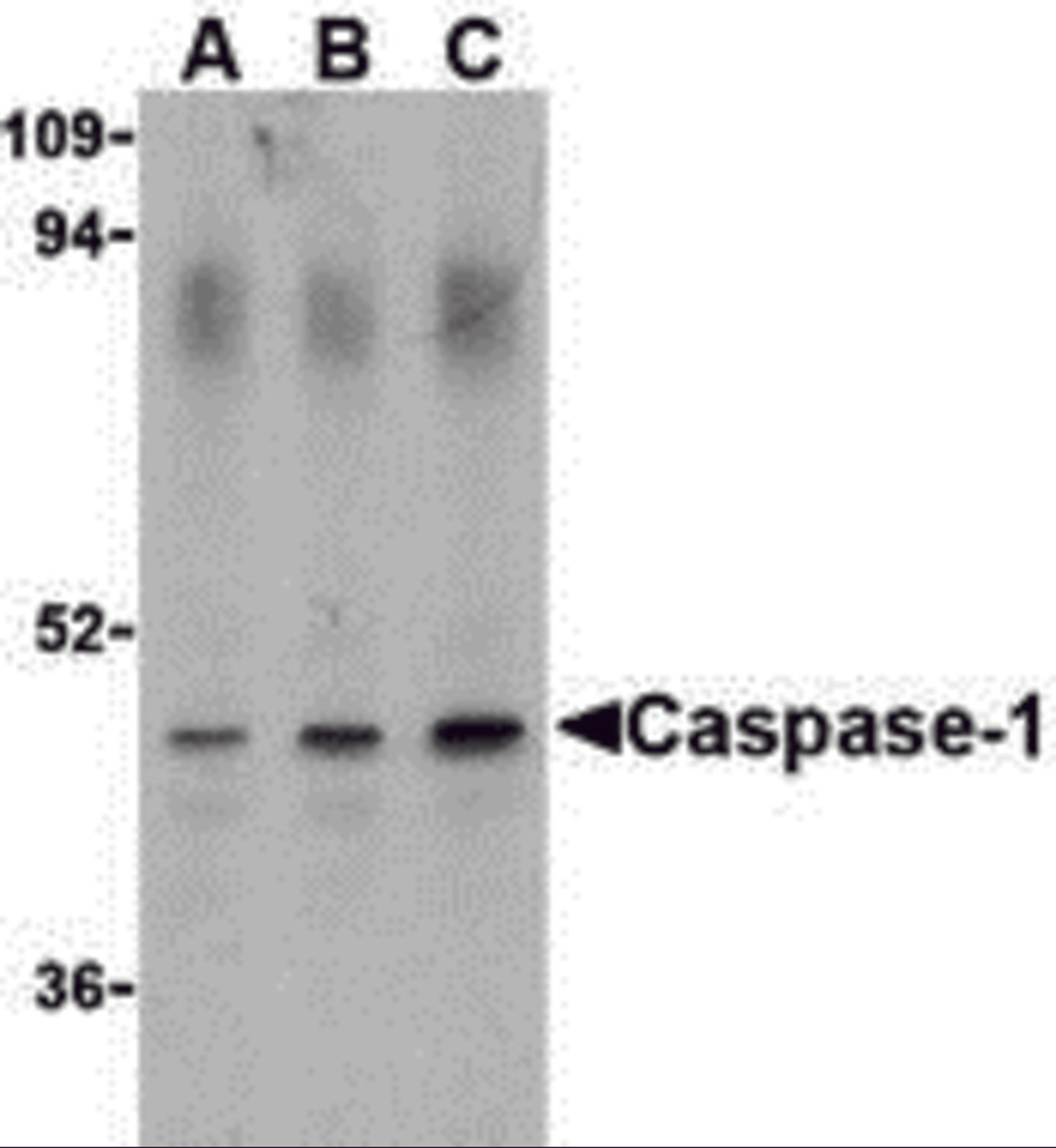 Western blot analysis of Caspase-1 in HeLa cell lysate with Caspase-1 antibody (IN) at (A) 0.5, (B) 1, and (C) 2 &#956;g/mL.