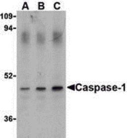 Western blot analysis of Caspase-1 in HeLa cell lysate with Caspase-1 antibody (IN) at (A) 0.5, (B) 1, and (C) 2 μg/mL.