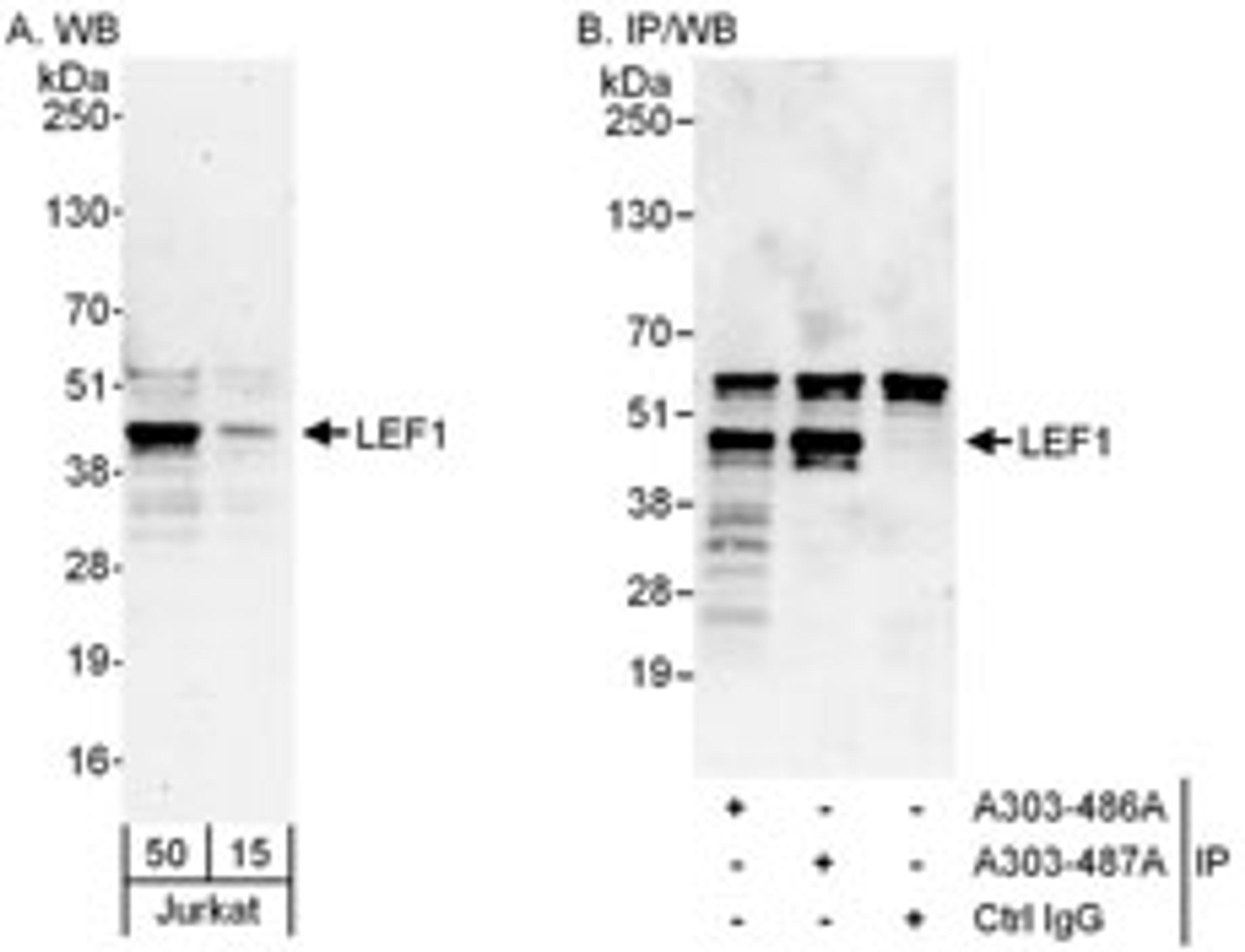 Detection of human LEF1 by western blot and immunoprecipitation.