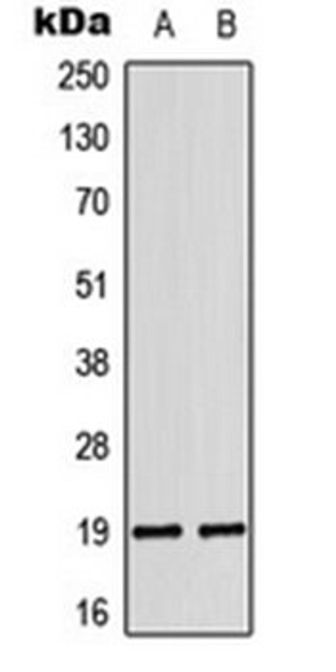 Western blot analysis of DU145 (Lane 1), K562 (Lane 2) whole cell lysates using LATH antibody