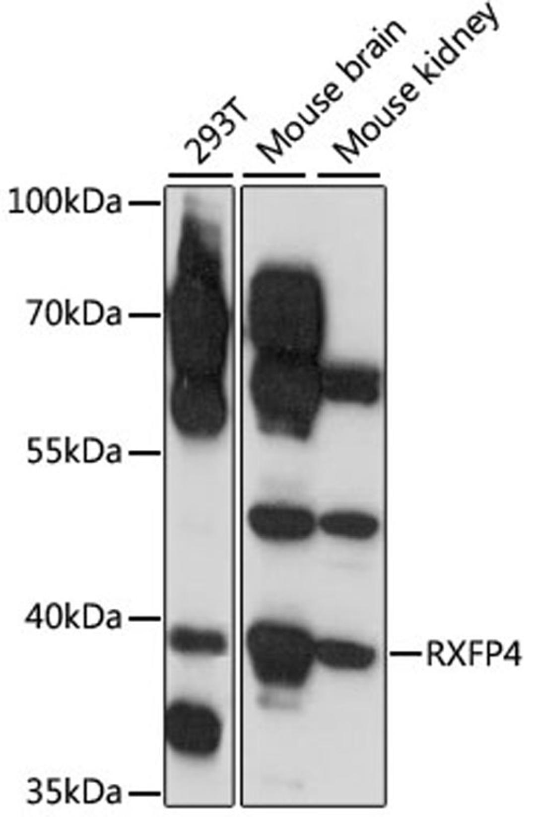 Western blot - RXFP4 antibody (A15978)