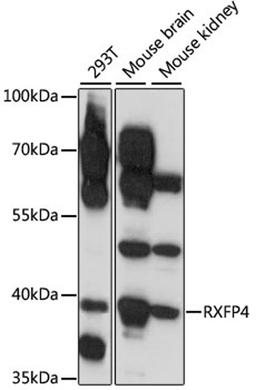 Western blot - RXFP4 antibody (A15978)