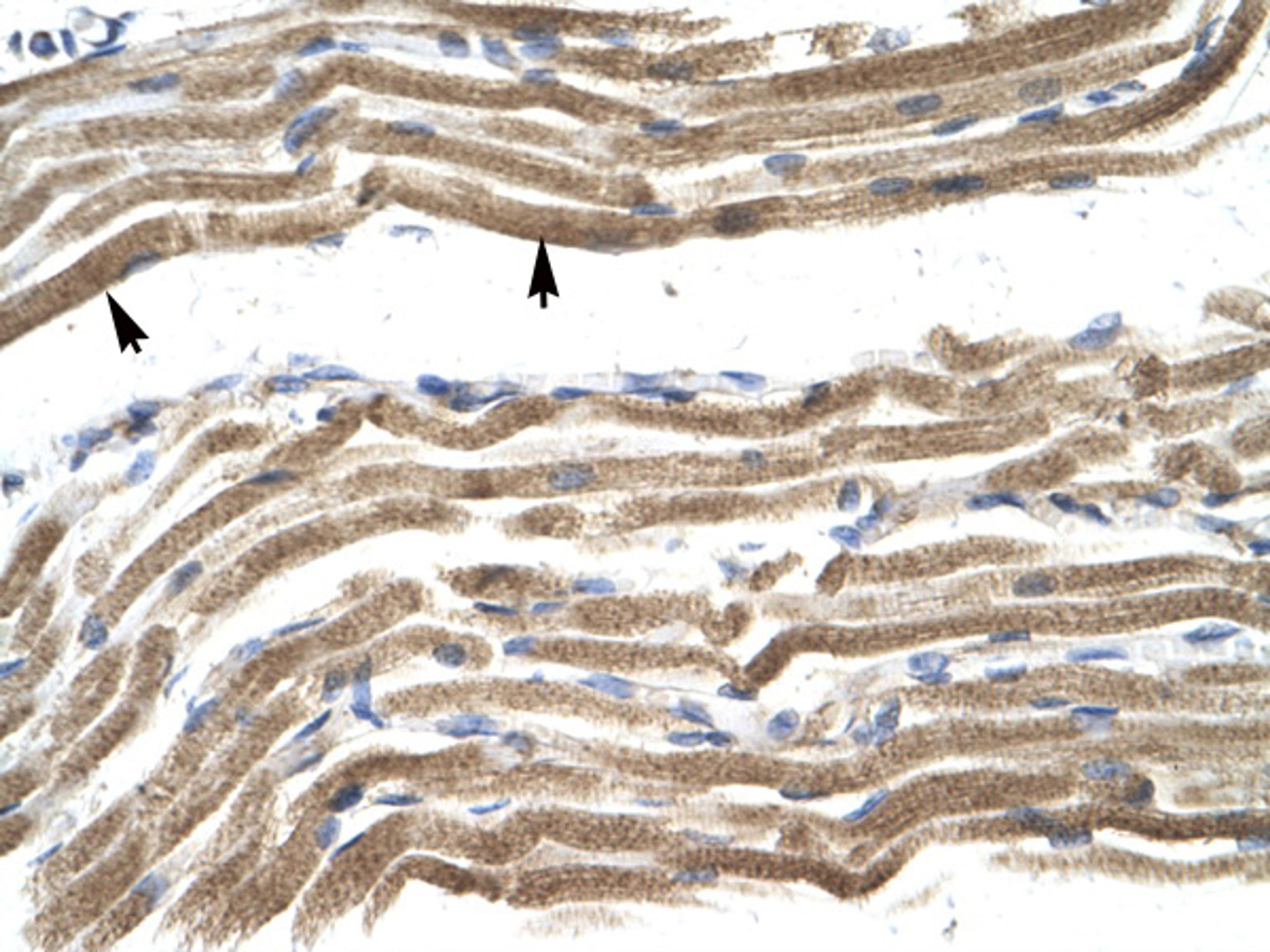 Antibody used in IHC on Human Muscle.