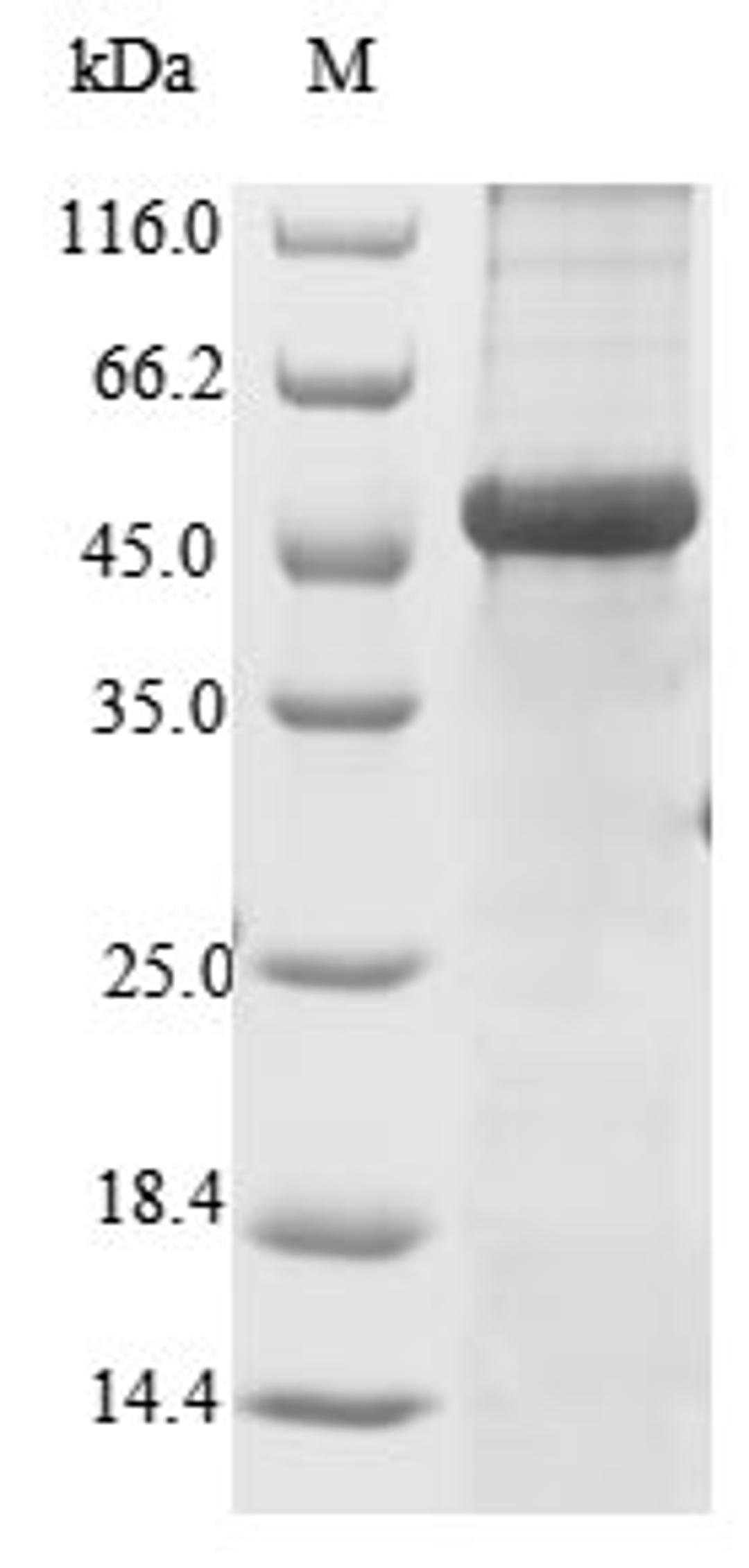 (Tris-Glycine gel) Discontinuous SDS-PAGE (reduced) with 5% enrichment gel and 15% separation gel.