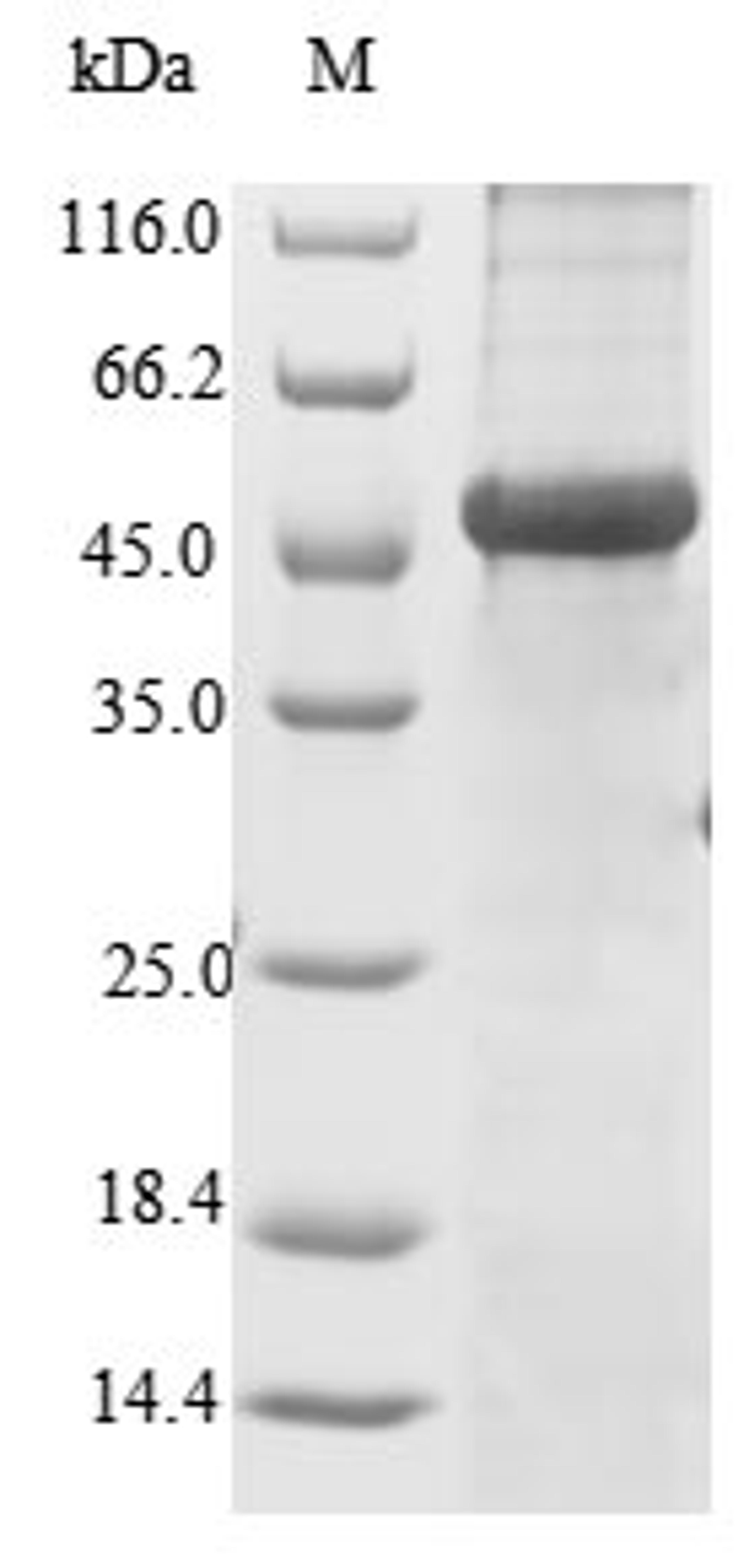 (Tris-Glycine gel) Discontinuous SDS-PAGE (reduced) with 5% enrichment gel and 15% separation gel.