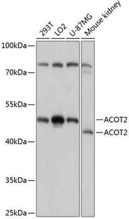 Western blot - ACOT2 antibody (A14390)