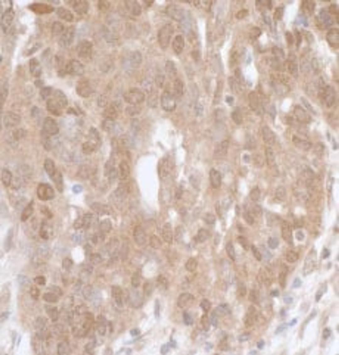 Detection of human MK5 by immunohistochemistry.