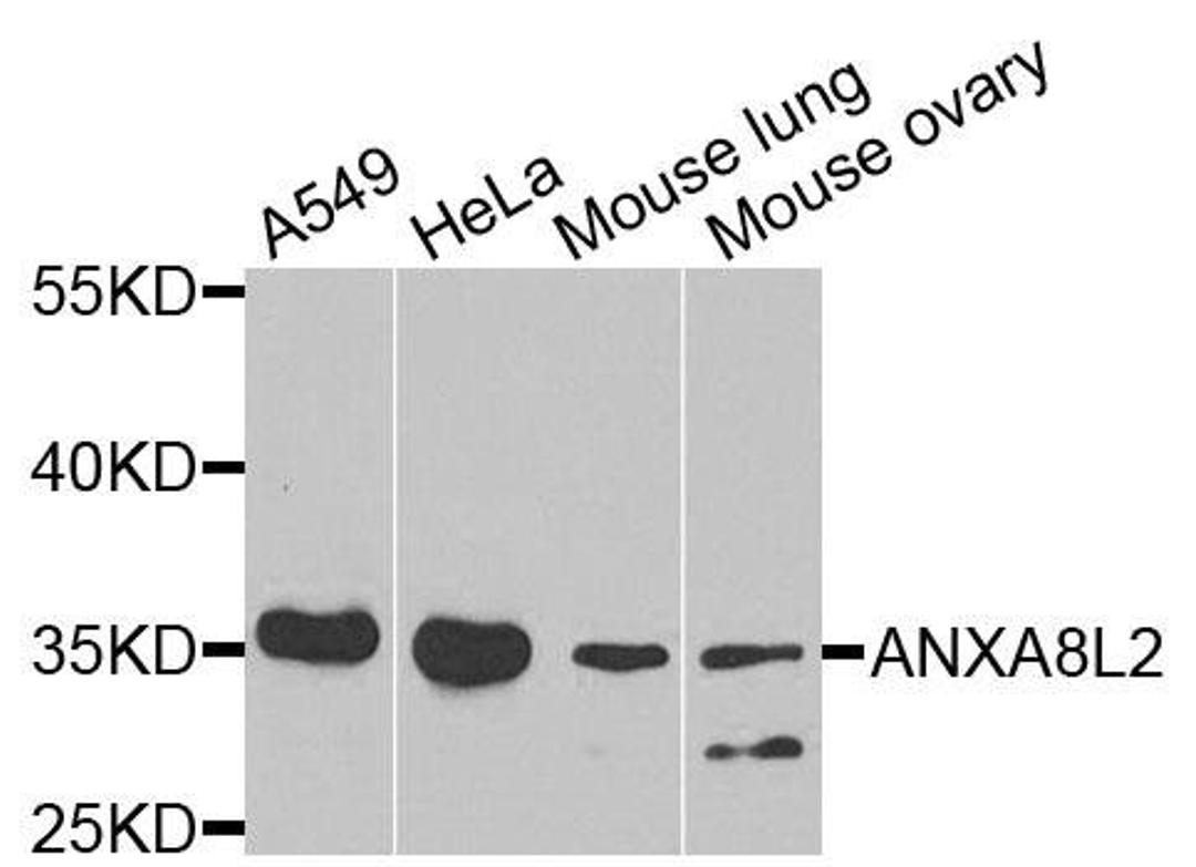 Western blot analysis of extracts of various cells using ANXA8L2 antibody