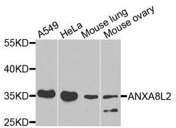 Western blot analysis of extracts of various cells using ANXA8L2 antibody