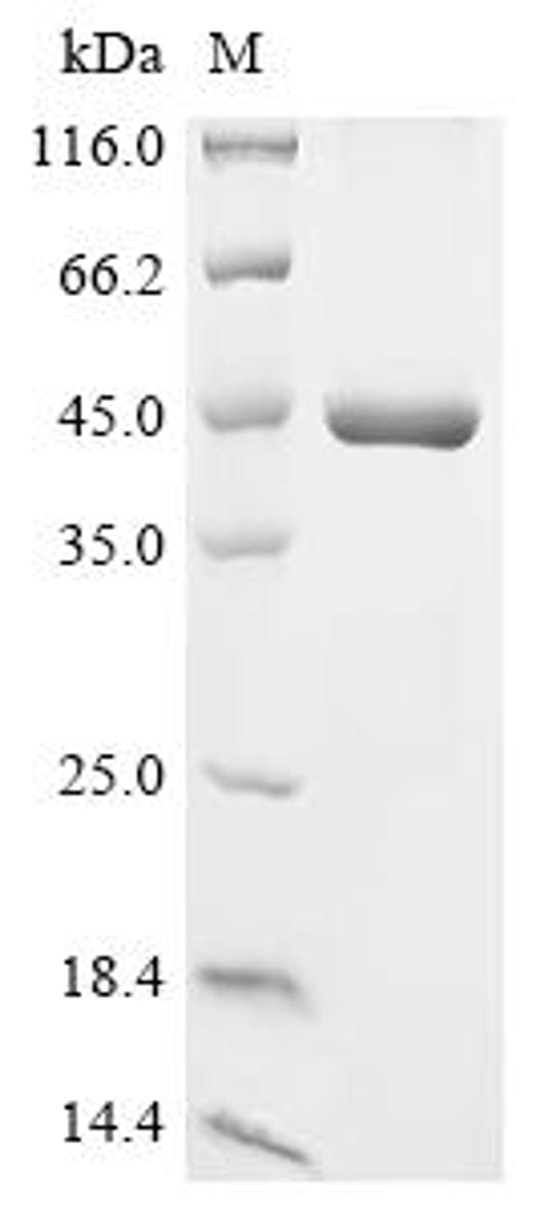 (Tris-Glycine gel) Discontinuous SDS-PAGE (reduced) with 5% enrichment gel and 15% separation gel.