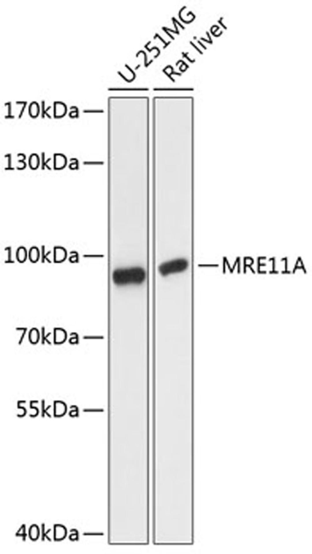 Western blot - MRE11A antibody (A14026)