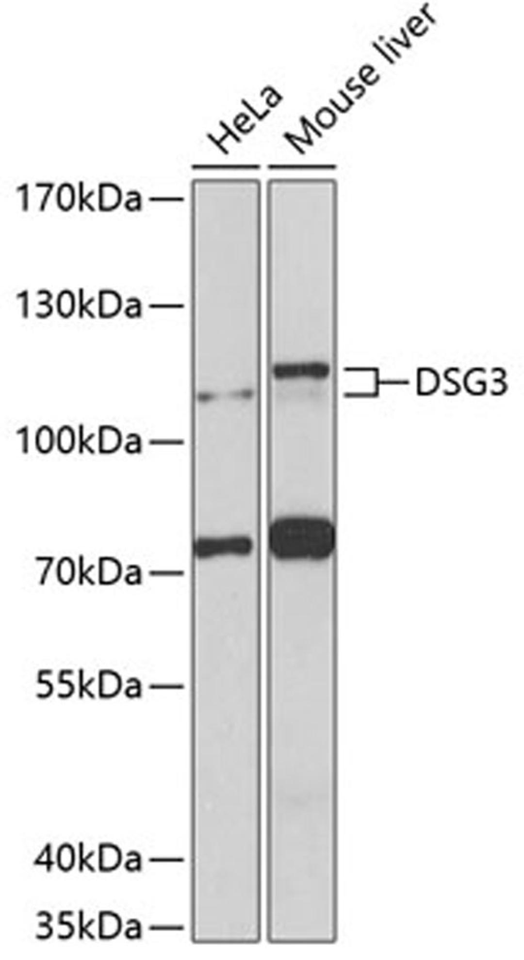 Western blot - DSG3 antibody (A8412)