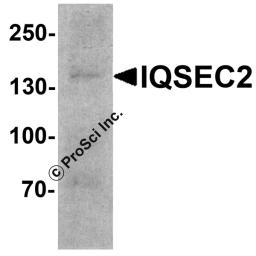 Western blot analysis of IQSEC2 in SK-N-SH cell lysate with IQSEC2 antibody at 1 &#956;g/ml.