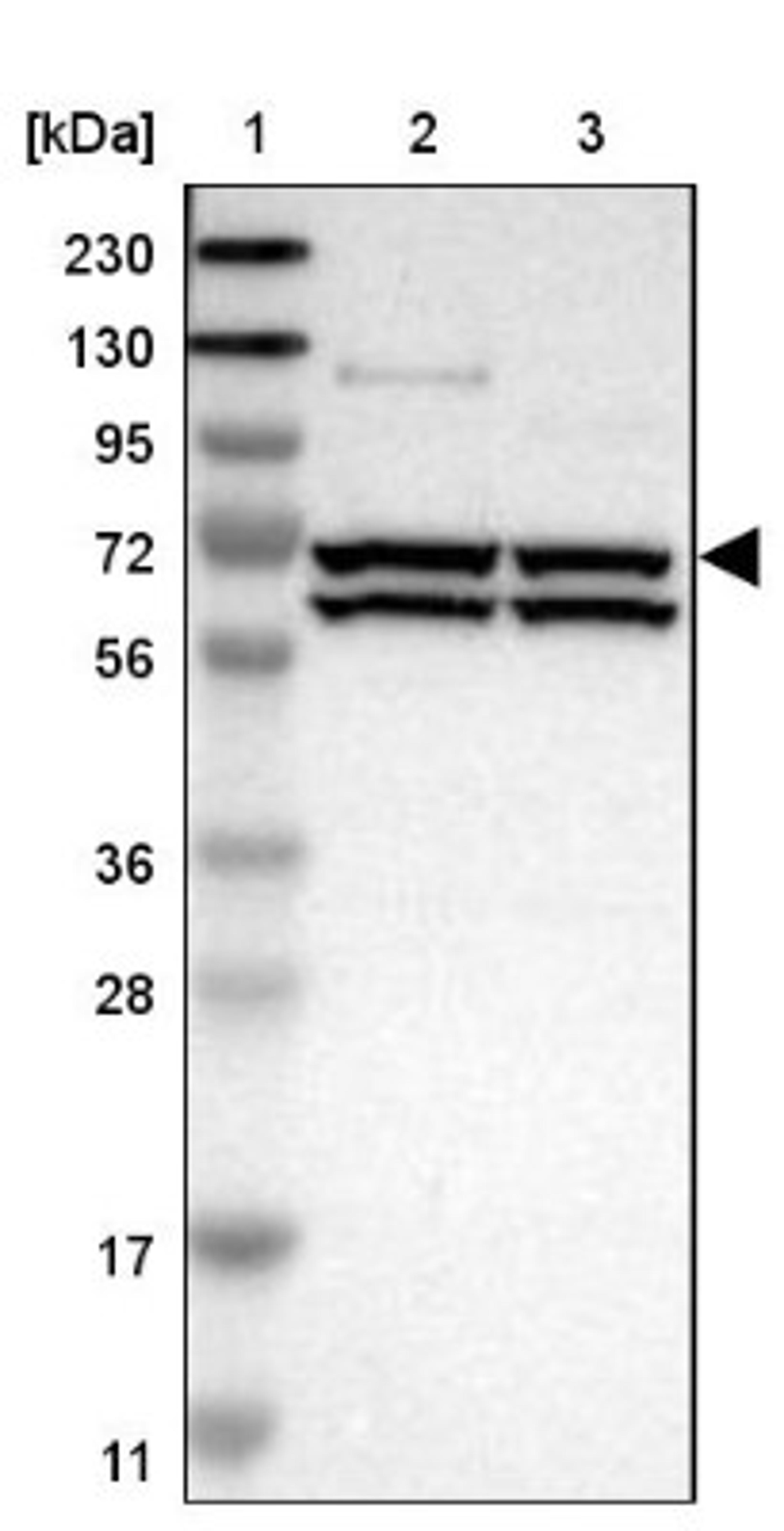 Western Blot: Kv1.4 Antibody [NBP1-89691] - Lane 1: Marker [kDa] 230, 130, 95, 72, 56, 36, 28, 17, 11<br/>Lane 2: Human cell line RT-4<br/>Lane 3: Human cell line U-251MG sp