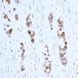 Detection of human PCNA by immunohistochemistry.