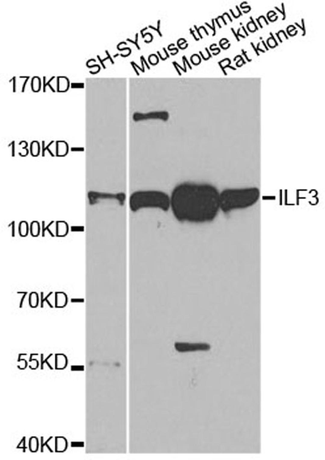 Western blot - ILF3 antibody (A14006)