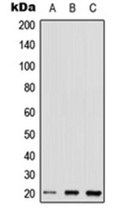 Western blot analysis of HEK293T (Lane 1), Raw264.7 (Lane 2), H9C2 (Lane 3) whole cell lysates using RHOQ antibody