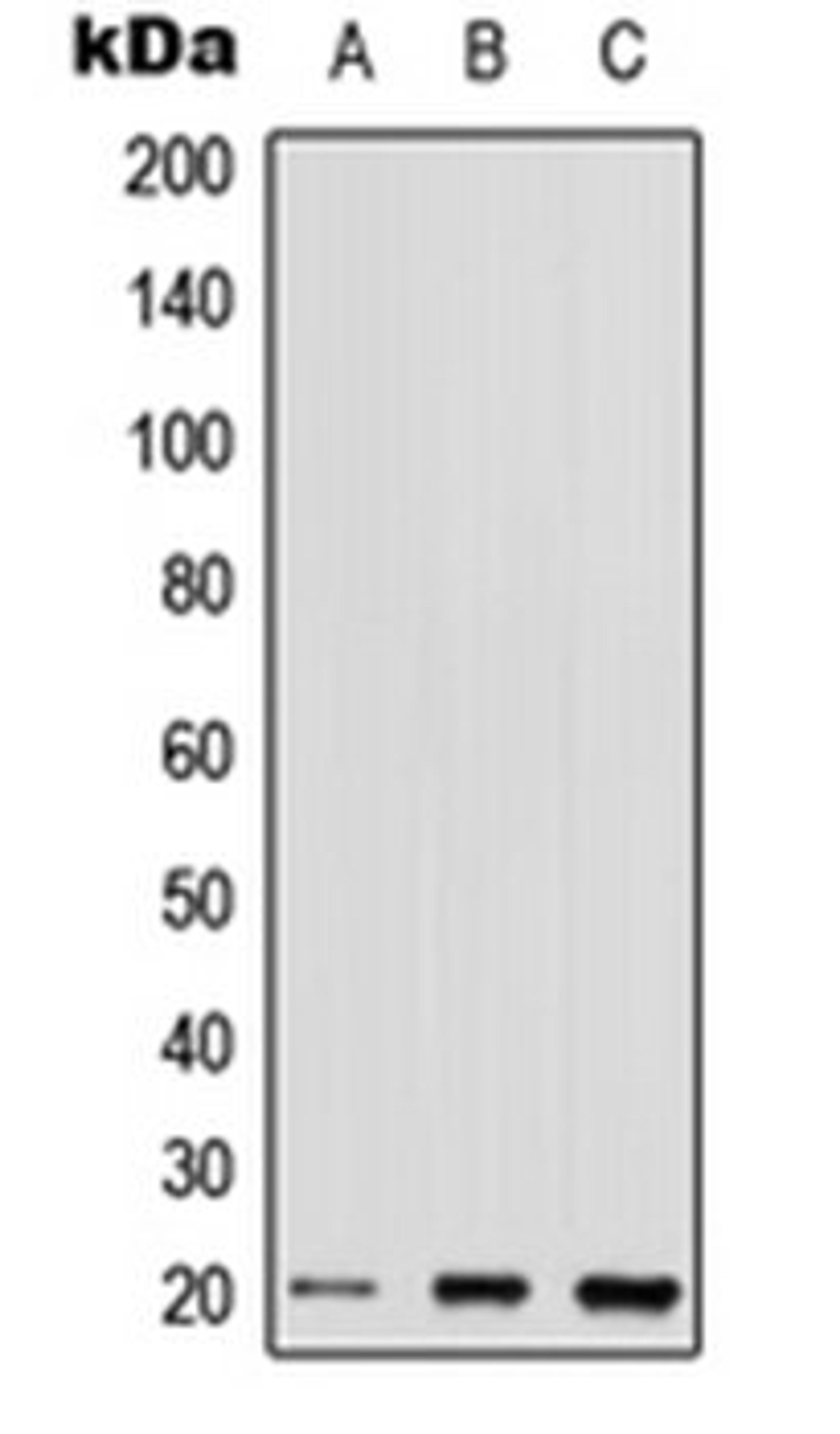 Western blot analysis of HEK293T (Lane 1), Raw264.7 (Lane 2), H9C2 (Lane 3) whole cell lysates using RHOQ antibody