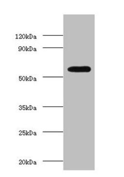 Western blot. All lanes: OXCT1 antibody at 2µg/ml + Hela whole cell lysate. Secondary. Goat polyclonal to rabbit IgG at 1/15000 dilution. Predicted band size: 57, 14 kDa. Observed band size: 57 kDa