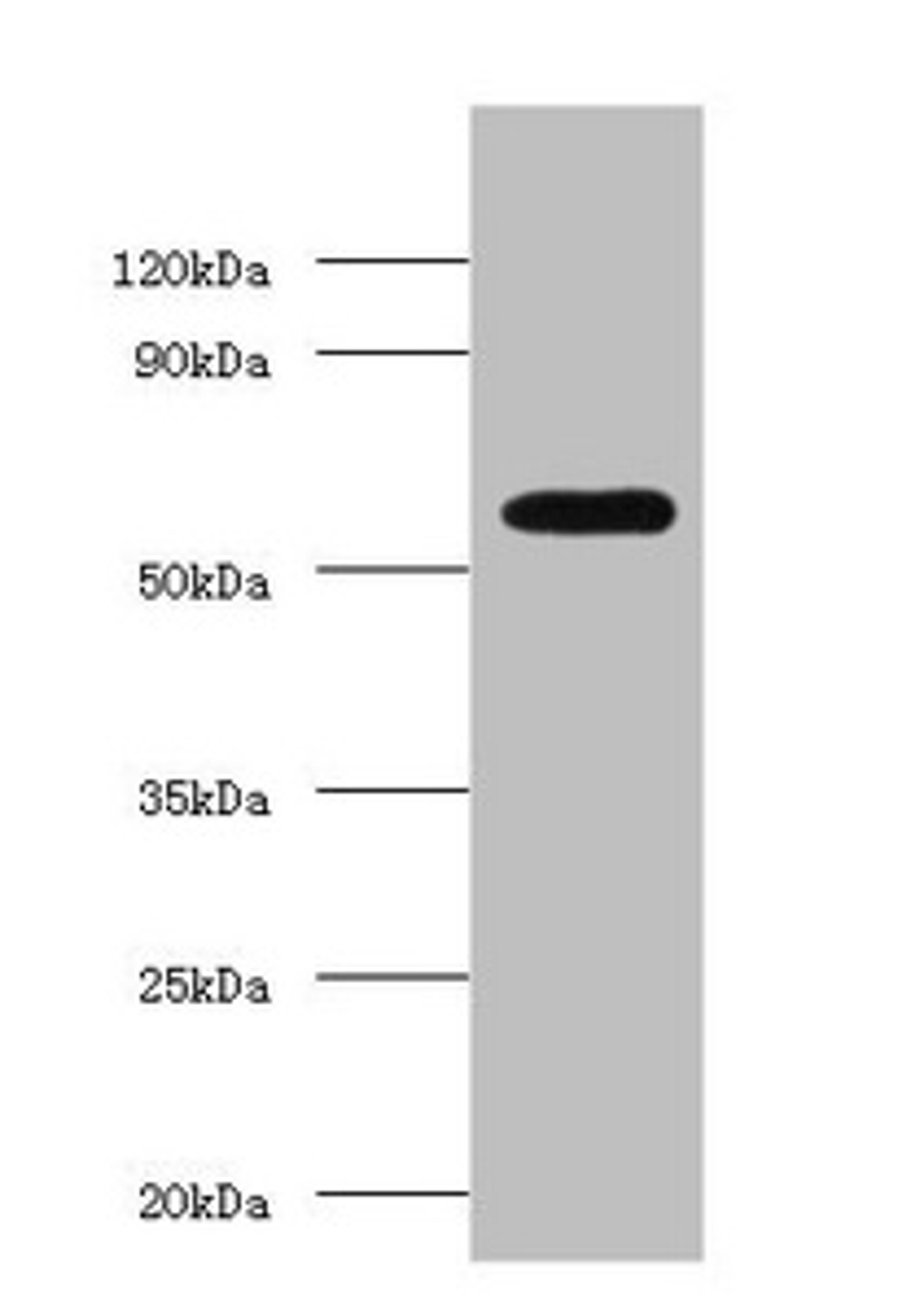 Western blot. All lanes: OXCT1 antibody at 2µg/ml + Hela whole cell lysate. Secondary. Goat polyclonal to rabbit IgG at 1/15000 dilution. Predicted band size: 57, 14 kDa. Observed band size: 57 kDa