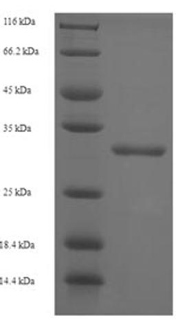 (Tris-Glycine gel) Discontinuous SDS-PAGE (reduced) with 5% enrichment gel and 15% separation gel.