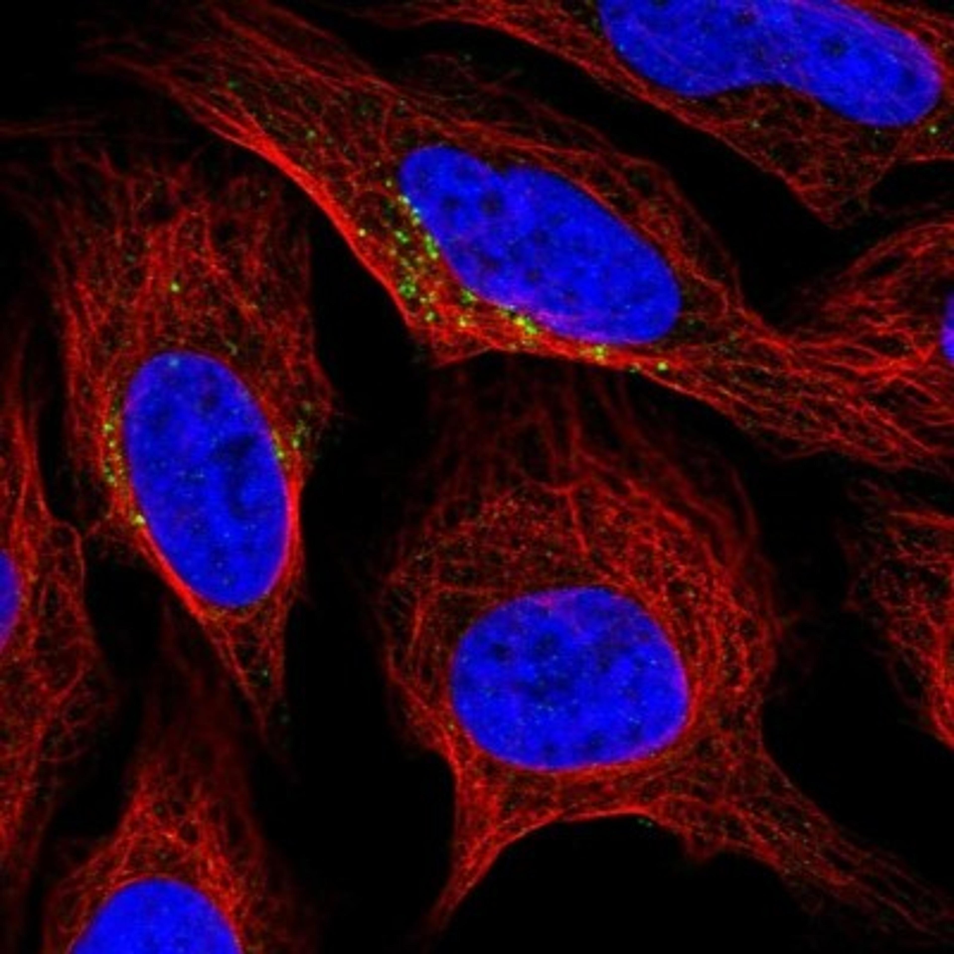 Immunocytochemistry/Immunofluorescence: PITX3 Antibody [NBP1-92274] - Staining of human cell line U-2 OS shows positivity in vesicles.