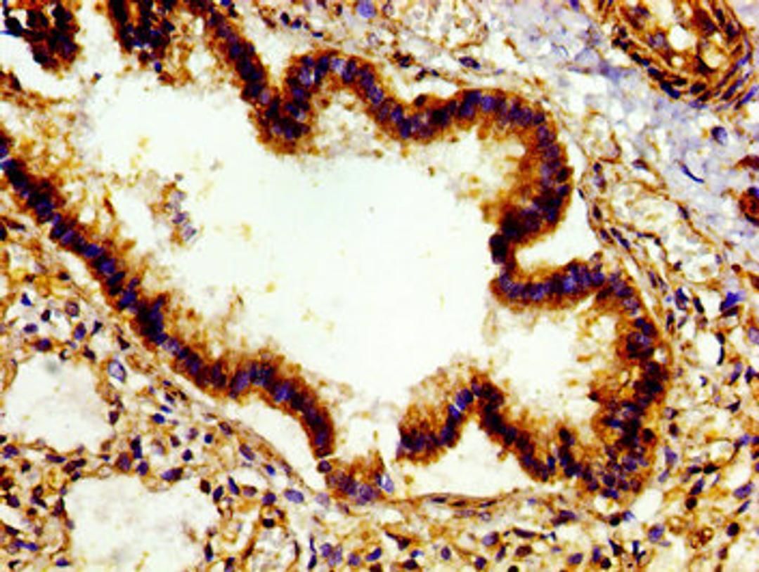 Immunohistochemistry of paraffin-embedded human lung tissue using CSB-PA00759A0Rb at dilution of 1: 100
