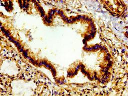 Immunohistochemistry of paraffin-embedded human lung tissue using CSB-PA00759A0Rb at dilution of 1: 100