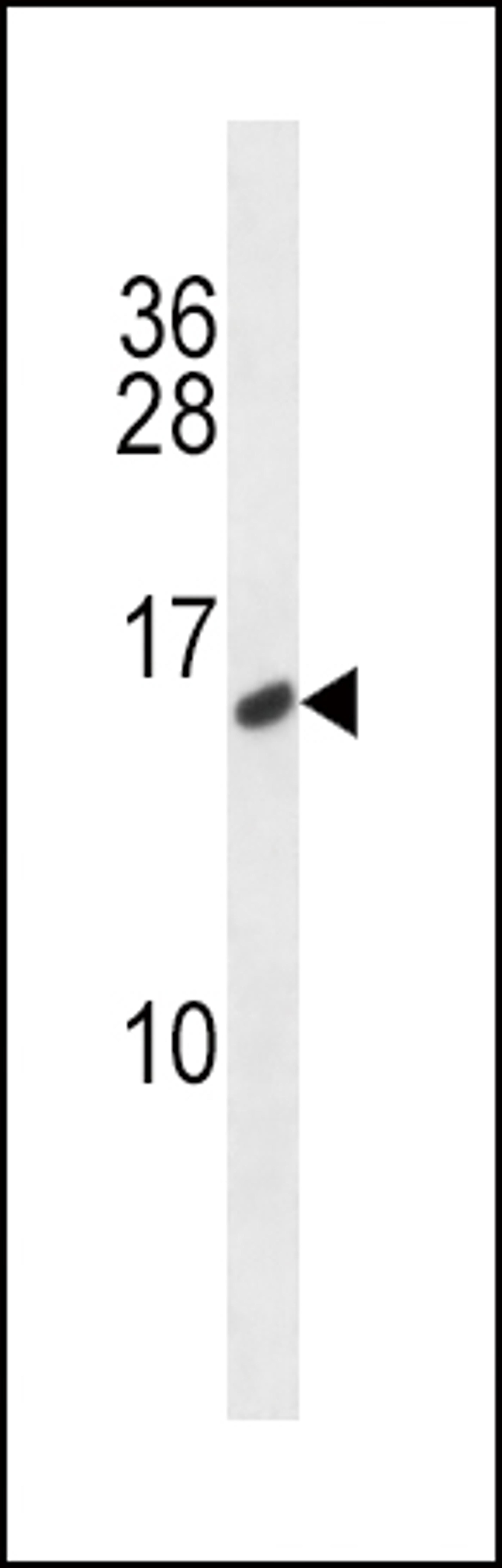 Western blot analysis in MDA-MB231 cell line lysates (35ug/lane).