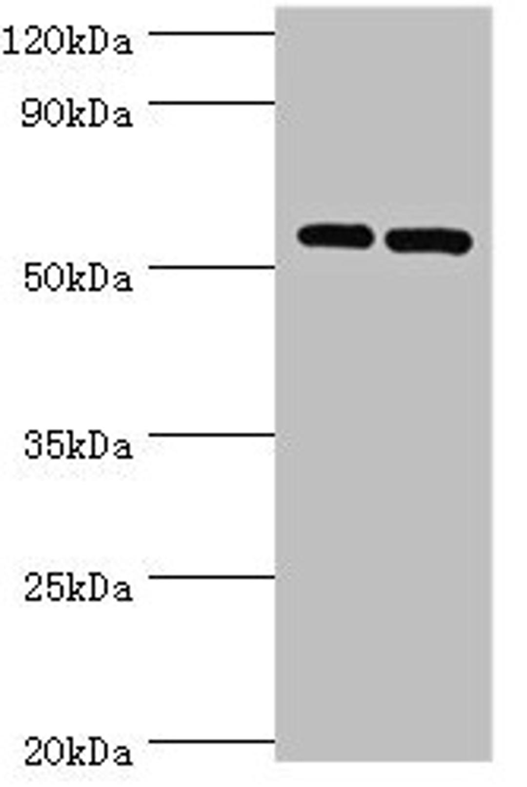 Western blot. All lanes: PNPLA2 antibody at 10µg/ml. Lane 1: A431 whole cell lysate. Lane 2: Hela whole cell lysate. Secondary. Goat polyclonal to rabbit IgG at 1/10000 dilution. Predicted band size: 56, 20 kDa. Observed band size: 56 kDa